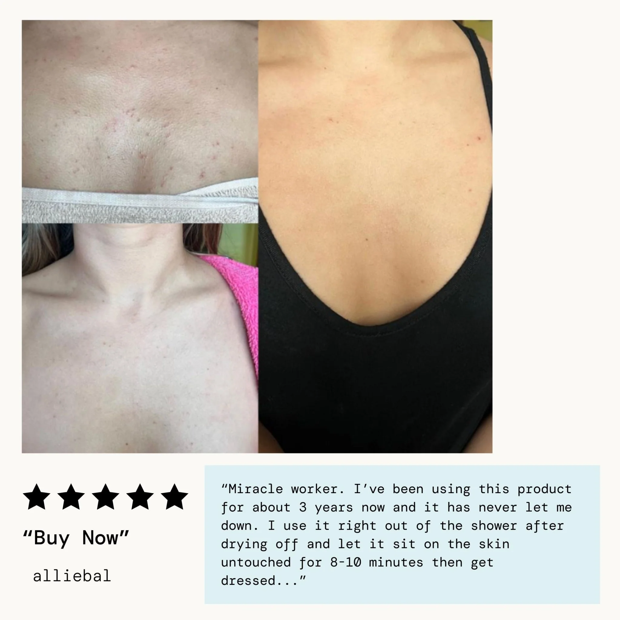 Bacne Warrior Acne Fighting Body Spray - Image 12