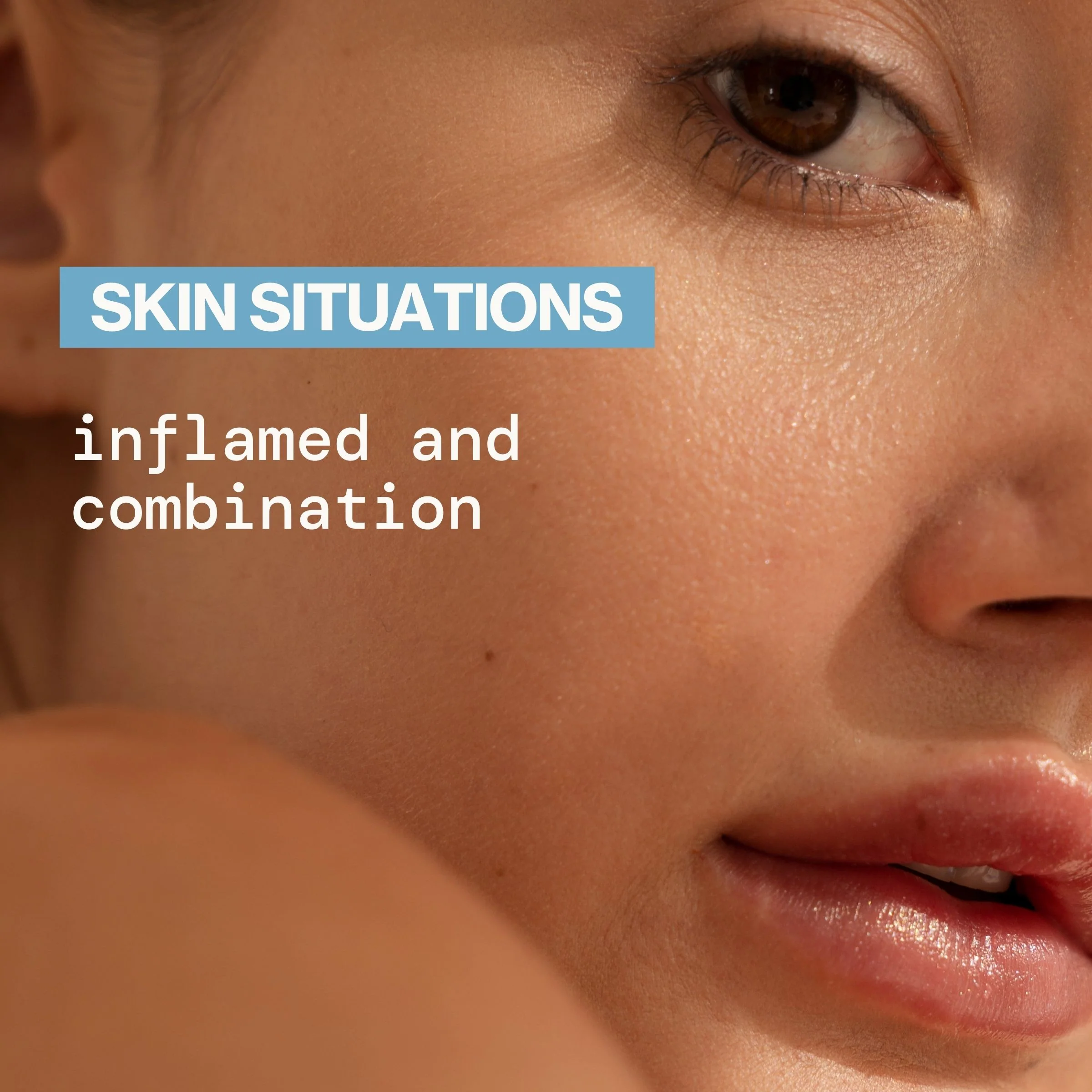 Comfort Space Skinflammation Calming Mask - Image 7