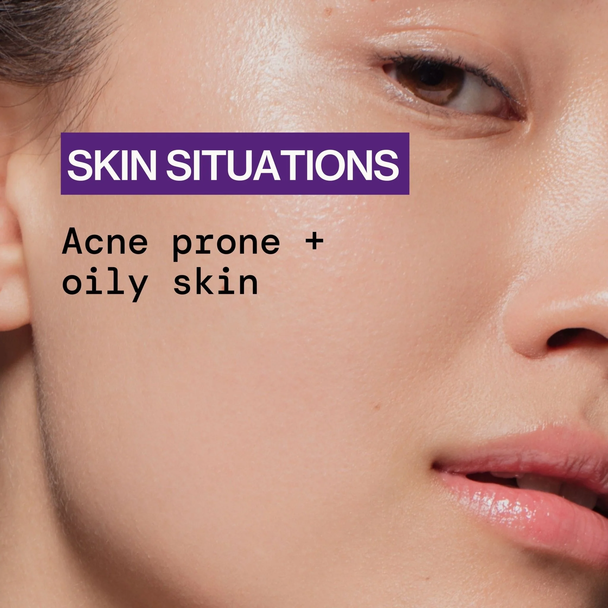 Dry It Out Acne Gel Spot Treatment - Image 11