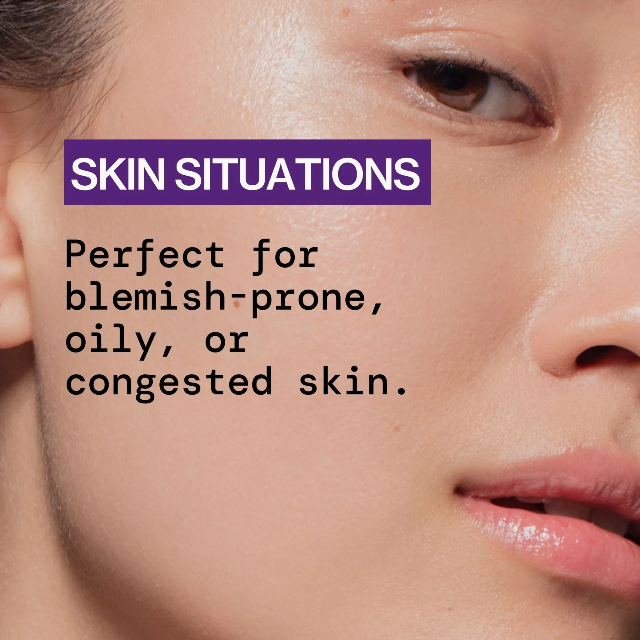 Pore Warrior Overnight Rescue Spot Dots - Image 8